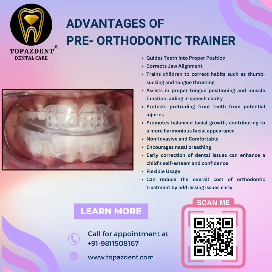 The Advantages of Pre-Orthodontic Trainers in Children: A Head Start for Healthy Smiles